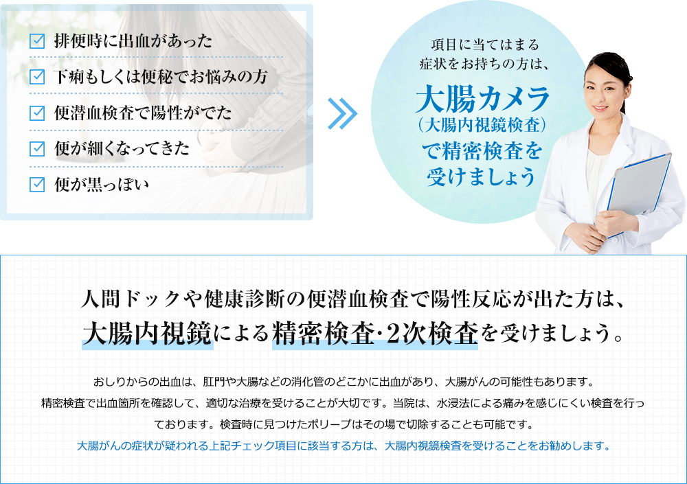 大腸カメラ（大腸内視鏡）検査