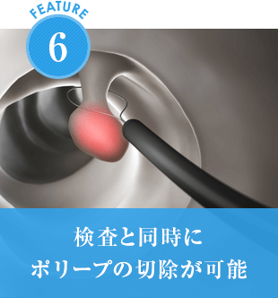 検査と同時にポリープの切除が可能